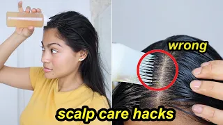 DANDRUFF CARE MISTAKES THAT WILL RUIN YOUR HAIR! | How to remove dandruff properly