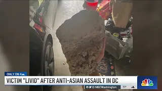 Victim of Suspected Anti-Asian Attack in DC Speaks Out | NBC4 Washington