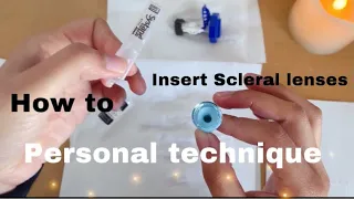 Inserting scleral lenses for Keratoconus-My entire process