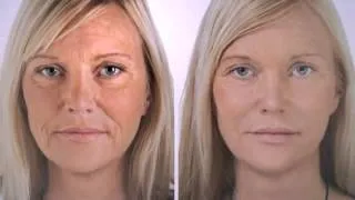 Wrinkle Rewind   Eliminate Wrinkles For Great Looking Skin!