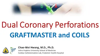 Dual Coronary Perforations: Graftmaster + Coils