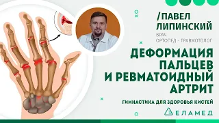 Деформация пальцев и ревматоидный артрит. Гимнастика для здоровья кистей | Павел Липинский