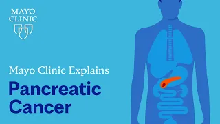 Mayo Clinic Explains Pancreatic Cancer
