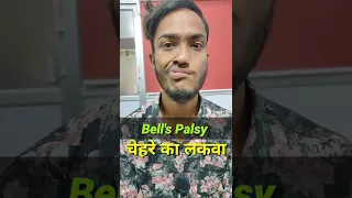 #shorts || चेहरे का लकवा || Bells Palsy Treatment