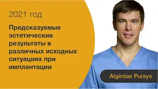 Предсказуемые эстетические результаты в различных исходных ситуациях при имплантации.