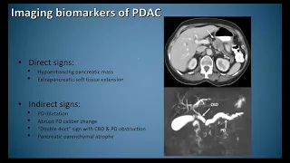 Imaging Biomarkers in Pancreatic Cancer: How Radiologists Can Make a Real Difference