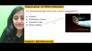 Movement disorders and site |Mnemonic of the day |Dr.Nikita Nanwani #nikmonics #neetpg #fmge #usmle