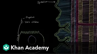 What is cholera? | Gastrointestinal system diseases | NCLEX-RN | Khan Academy