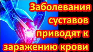 БОЛЬ В КОЛЕНЯХ УШЛА за 2 часа НАРОДНОЕ средство от АРТРОЗА #здоровье