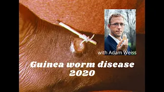 Guinea worm disease 2020 with the Carter Center’s Adam Weiss