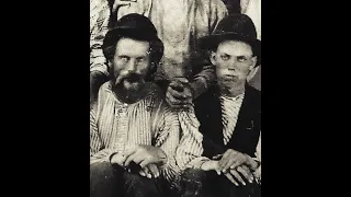 The Freakiest Damn Billy the Kid Photo EVER!!