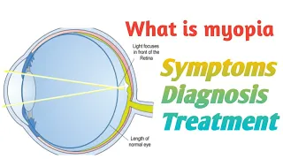 Eye Defect _Myopia/Don't Memorise