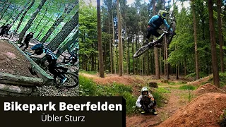 Übler Sturz/Platzwunde/Bikepark Beerfelden 2021