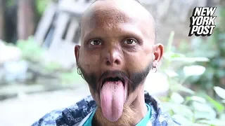 Man Can Lick His Own Forehead with 'World's Longest Tongue' | New York Post