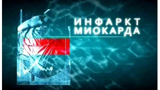 Инфаркт миокарда