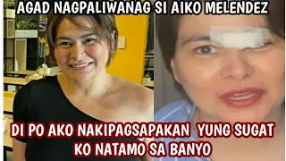 AIKO MELENDEZ AGAD NAGPALIWANG HINGIL SA  PAGKALAT NG SUGAT NIYA SA NOO KESYO NAKIPAGSAPAKAN DAW