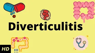 Diverticulitis, Causes, SIgns and Symptoms, Diagnosis and Treatment.