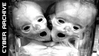 15 Disturbing Human Experiments That Actually Happened