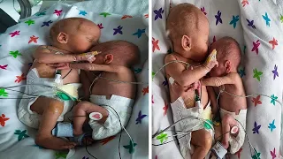 Nurse put the healthy Baby next to her dy**ing twin and a real miracle Happened!