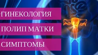 ПОЛИП ПОЛОСТИ МАТКИ - симптомы заболевания