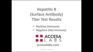 Hepatitis B Titer - Hep B Surface Antibody Test Results Overview