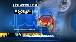 Saliva could be used to diagnose Parkinson's: Study