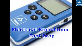 Quick set up : Electrical Stimulation for foot drop