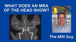 What does an MRA head show?