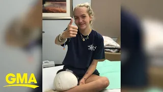 Teen finds her way back to the ocean 1 year after losing leg from shark bite l GMA