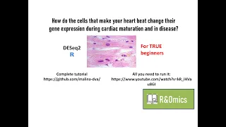 RNA-seq: Data normalization and clustering in R (beginners)