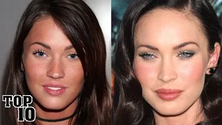 Top 10 Celebrities You Didn’t Know Had Plastic Surgery