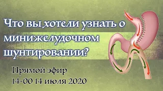 Минижелудочное шунтирование (mini gastric bypass, минишунт, OAGB)