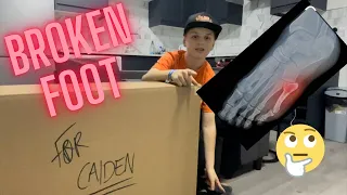 Broken foot plus big unboxing