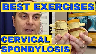 4 Best Exercises for Cervical Spondylosis | Dr. Walter Salubro Chiropractor in Vaughan ON