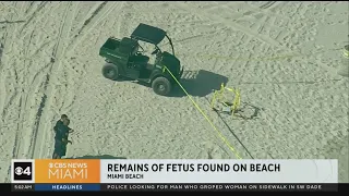 Remains of a fetus found on Miami Beach