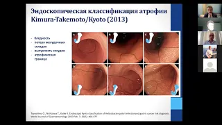 3. Ткаченко М.А Своевременное выявление предраковых изменений и заболеваний желудка в клин практике