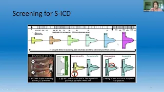 ICD/S-ICD: Differences and everyday tips