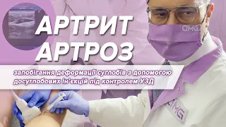 Артрит, артроз - запобігання деформації суглобів з допомогою досуглобових ін’єкцій під контролем УЗД