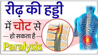 रीढ़ की हड्डी में चोट से हो सकता है Paralysis | Spinal Cord Injury Treatment | Dr. Puru Dhawan