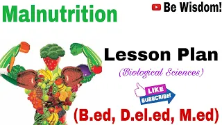 Biological Science Malnutrition Lesson Plan (कुपोषण - पाठयोजना जीवविज्ञान) MicroTeaching B.ed #csjmu