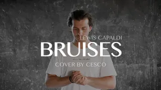 bruises x lewis capaldi (Cover by Cesco)