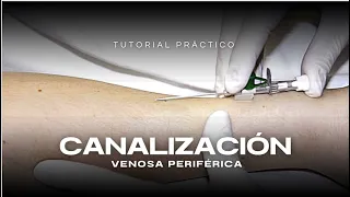 CANALIZACIÓN VENOSA | TUTORIAL PRÁCTICO