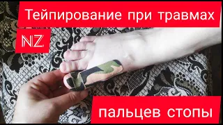 Тейпирование при травмах пальцев стопы.