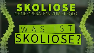 Was ist SKOLIOSE? | Ist eine Skoliose GEFÄHRLICH? | EINFACHE ERKLÄRUNG + BESTE BEHANDLUNG