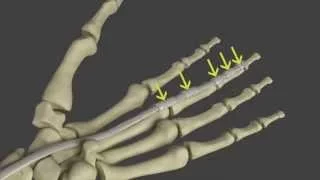Trigger Finger: Symptoms and Anatomy