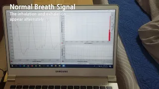 Sleep apnea detection by Breath Sensor