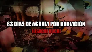 83 DÍAS DE AGONÍA POR RADIACIÓN - HISACHI OUCHI