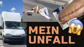 Unfall als Bodybuilder - Mein Weg zur Normalität