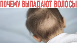 ВЫПАДЕНИЕ ВОЛОС У МЛАДЕНЦА | Почему выпадают волосы у маленьких детей Как избежать выпадения волос