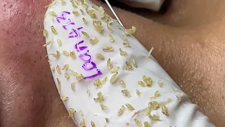 Satisfying With Loan Nguyen Spa Video #013